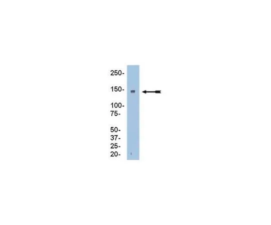 62-8389-30　［Discontinued］Anti-RFC1; 100 μg　09-094