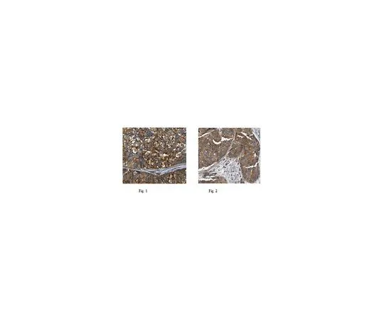 62-8458-54　［Discontinued］Anti-Tropomyosin Antibody, isoforms 5a, 5b, Br2, Br3 ABC499　ABC499
