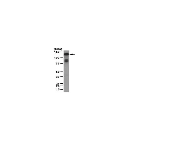 62-8389-54　［Discontinued］Anti-human Tks4; 100 μg　09-267