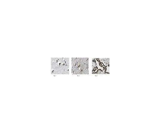 62-8517-58　［Discontinued］Anti-Tachykinin-3, clone 15D9.1　MABN370