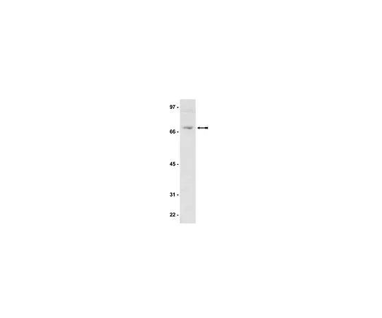 62-8384-88　［Discontinued］Anti-WAVE2/Scar2; 200 μL　07-410