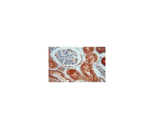 62-8464-97　［Discontinued］Anti-GALNS　ABF249