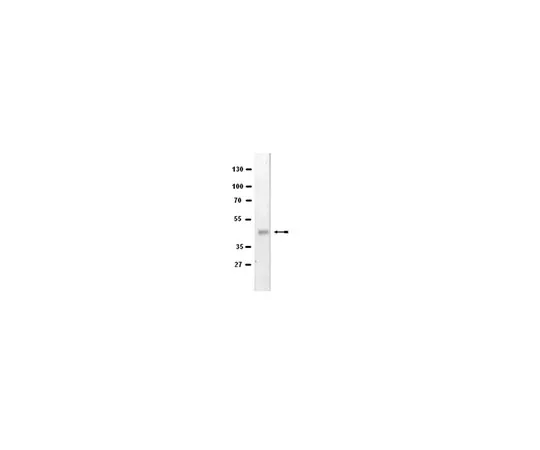 62-8368-01　［Discontinued］Anti-EAPP; 100 μL　04-086