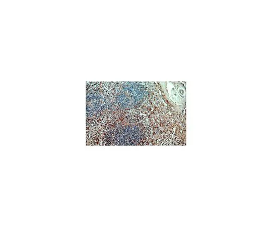 62-8458-01　［Discontinued］Anti-ARRB2　ABC405