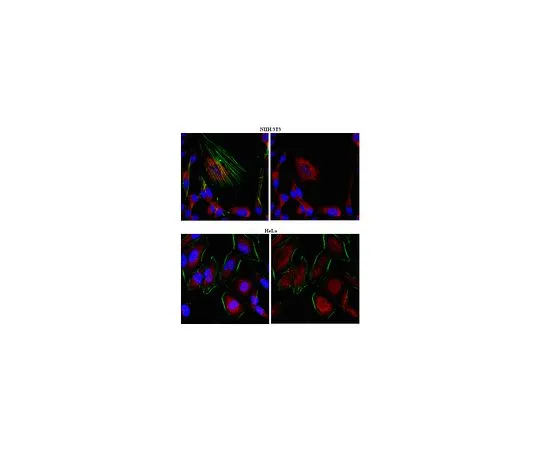 62-8472-34　［Discontinued］Anti-Fas-binding factor 1 (Albatross); 100 μg　ABT37