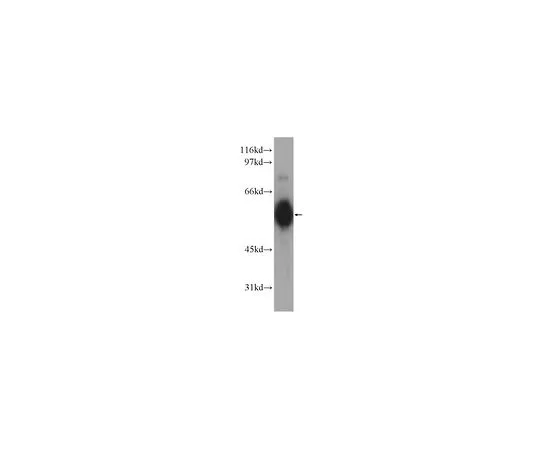 62-8467-66　［Discontinued］Anti-CHRNA5　ABN503