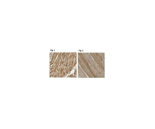 62-8457-57　［Discontinued］Anti-Tenomodulin/TNMD　ABC305