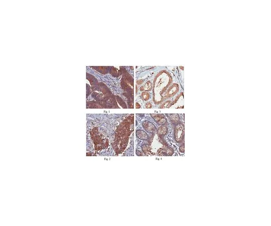 62-8457-08　［Discontinued］Anti-p53 Upregulated Modulator of Apoptosis (PUMA)　ABC158