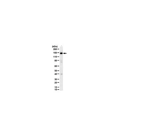 62-8387-12　［Discontinued］Anti-CtIP (RBBP-8); 100 μg　07-1010