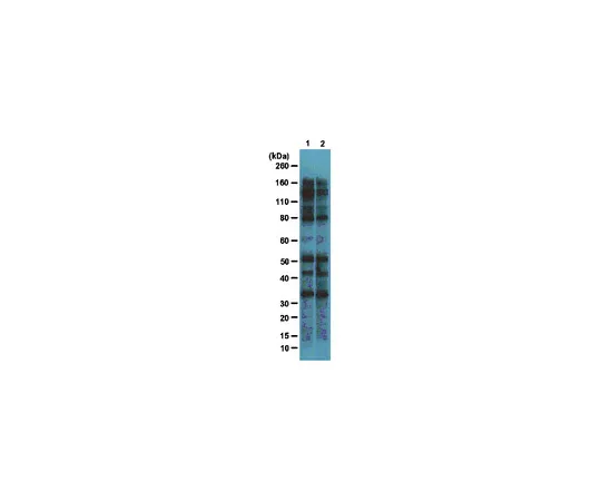 62-8374-48　［Discontinued］Anti-O-GlcNAc, clone 18B10.C7(3); 100 μg　05-1244