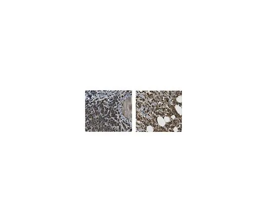 62-8463-45　［Discontinued］Anti-JARID1B/KDM5B　ABE1370