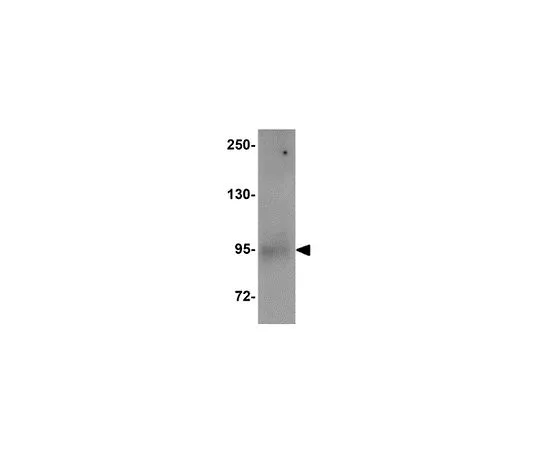 62-8470-02　［Discontinued］Anti-ZBED1　ABS438