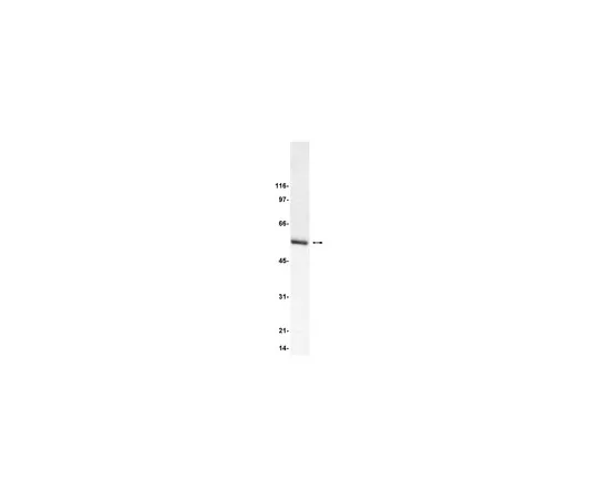 62-8371-75　［Discontinued］Anti-Tubulin, clone 2G10, neuronal; 200 μg　05-559