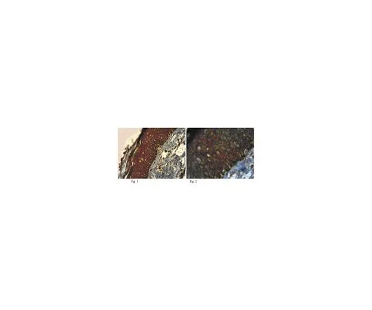 62-8455-85　［Discontinued］Anti-Neuregulin-2; 100 μg　AB15812
