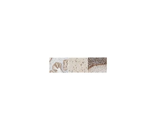62-8468-38　［Discontinued］Anti-IMPACT　ABN1444