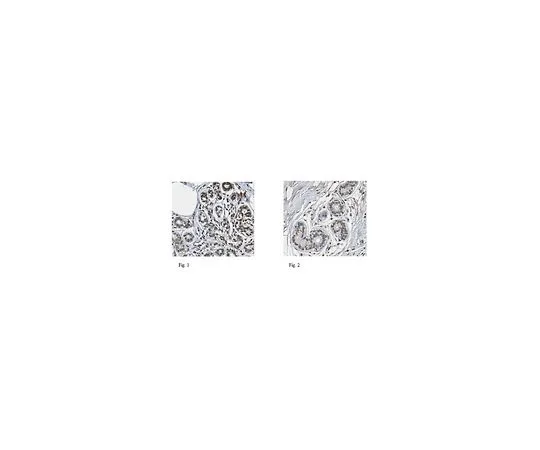 62-8501-97　［Discontinued］Anti-RARB, clone 11E8.1　MABC302
