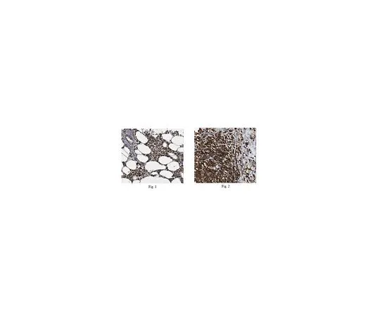 62-8464-43　［Discontinued］Anti-NLRP1 Antibody Cat. No. ABF22　ABF22