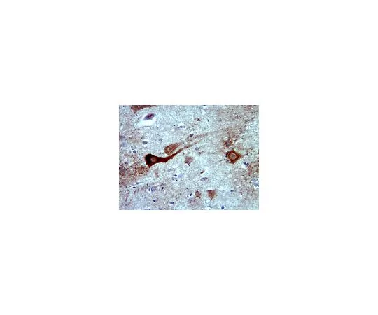 62-8465-54　［Discontinued］Anti-RYK; 100 μg　ABN64