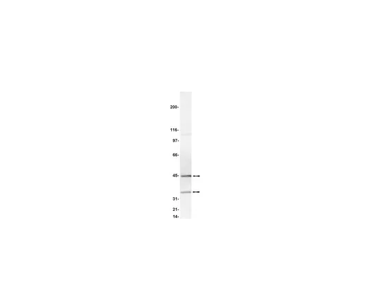 62-8371-78　［Discontinued］Anti-Caspase 9, clone 96-2-22; 100 μg　05-572