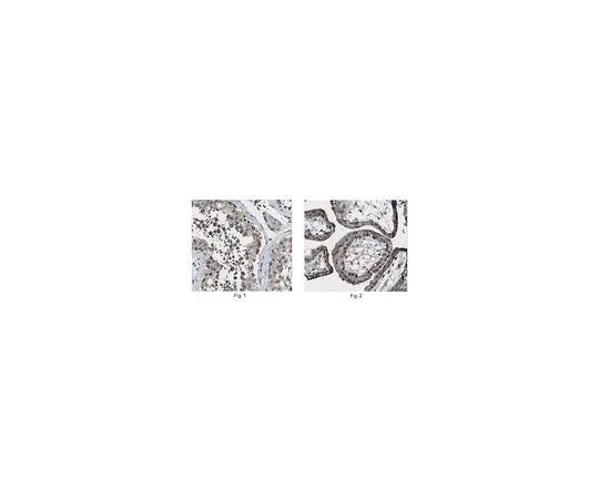 62-8462-83　［Discontinued］Anti-Cytosolic 5'-nucleotidase 1B　ABE1005