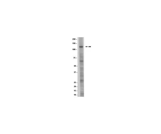 62-8498-30　［Discontinued］Anti-NMDAR2C; 100 μL　MAB5576
