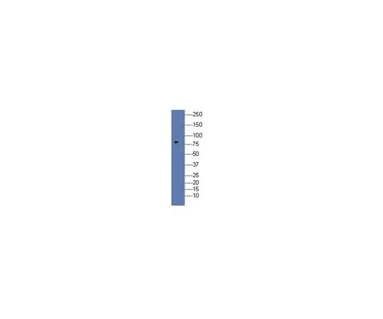 62-8455-61　［Discontinued］Anti-DCAMKL1 splice variant; 100 μg　AB15588