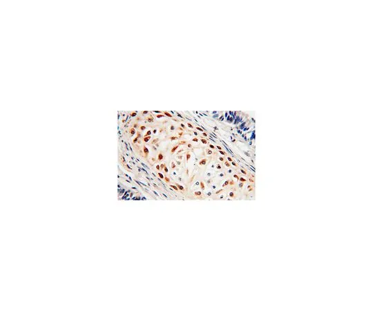 62-8458-02　［Discontinued］Anti-BCL2L10　ABC406