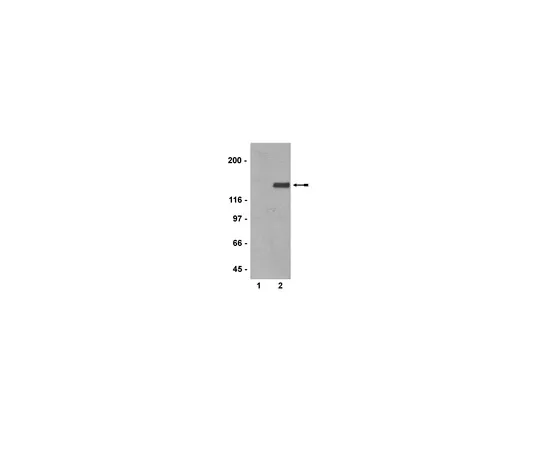 62-8372-85　［Discontinued］Anti-phospho-Neurofilament, medium chain, clone RMO55; 200 μL　05-774