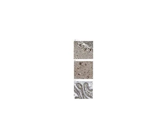 62-8470-79　［Discontinued］Anti-Adenylate cyclase type 5　ABS573