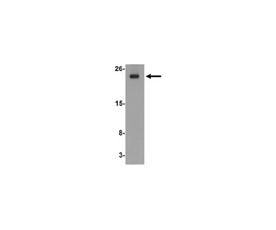62-8462-67　［Discontinued］Anti-Translin Antibody ABE795　ABE795