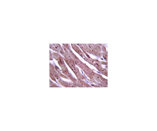 62-8382-88　［Discontinued］Anti-DKK2; 100 μg　06-1087