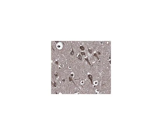 62-8466-65　［Discontinued］Anti-LGI2　ABN335