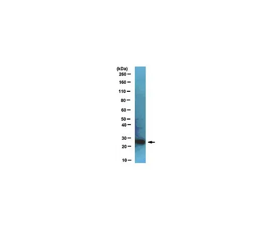 62-8465-27　［Discontinued］Anti-UCH-L1; 100 μg　ABN22