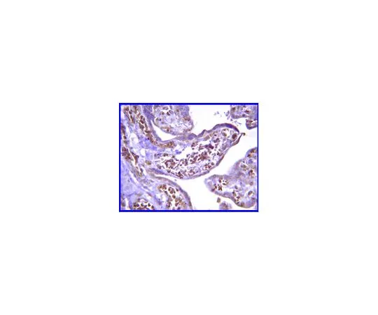 62-8387-87　［Discontinued］Anti-Calcineurin Bα; 100 μL　07-1494