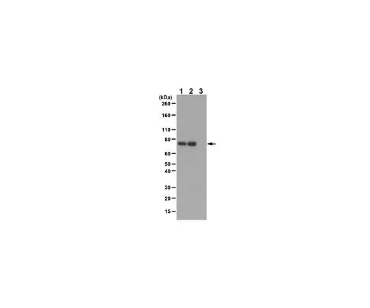 62-8386-88　［Discontinued］Anti-phospho-PKCß II (Thr641)　07-873-I