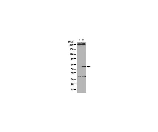 62-8469-12　［Discontinued］Anti-phospho-SMAD1 (Ser206)　ABS52