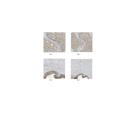 62-8473-53　［Discontinued］Anti-MMP-10　ABT289