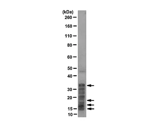 61-0210-01　［Discontinued］Apex Stainless Steel Discs in Tyvek/Tyvek G. Stearothermophilus(#7953) 106 100Discs　NAS-152