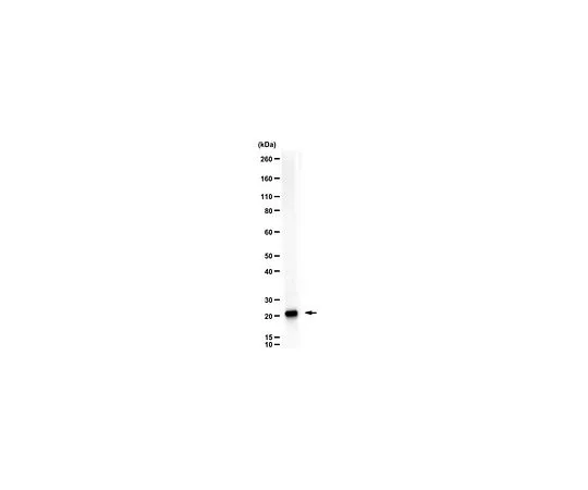 62-8463-57　［Discontinued］Anti-Ubiquityl Histone H2B (Lys120)　ABE1401
