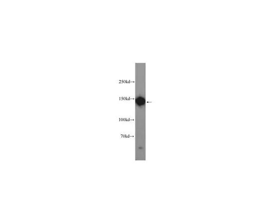 62-8473-54　［Discontinued］Anti-DSG2　ABT290