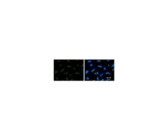 62-8507-64　［Discontinued］Anti-Nucleophosmin/B23/Numatrin, clone 28M1　MABE937