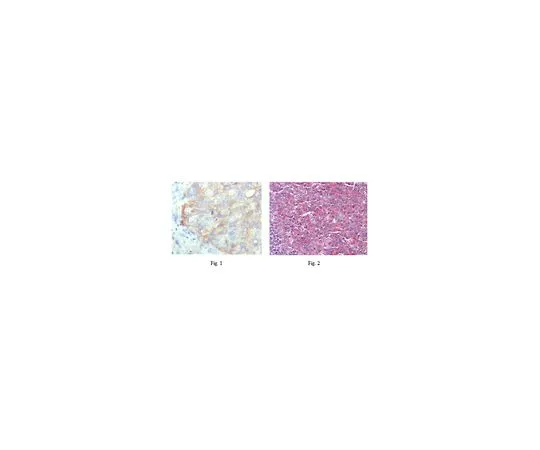 62-8509-18　［Discontinued］Anti-KARS, clone 8G12C1　MABF187