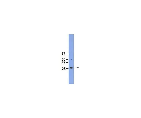 62-8389-43　［Discontinued］Anti-IGFBP-3; 100 μL　09-180