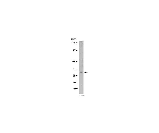 62-8446-92　［Discontinued］Anti-MMP-12, hinge region; 100 μg　AB2964