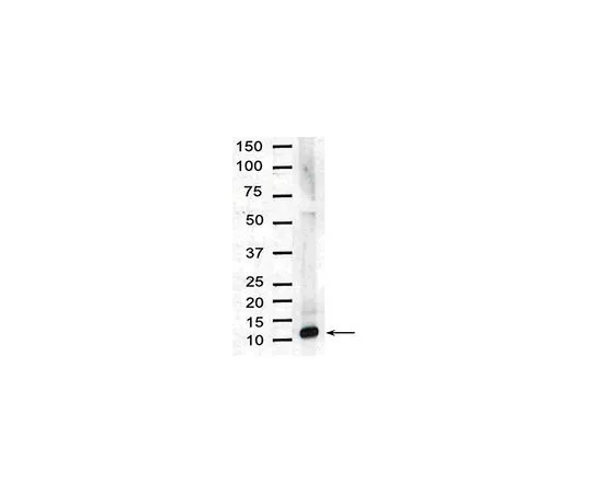 62-8444-96　［Discontinued］Anti-Interleukin-8; 100 μg　AB1427