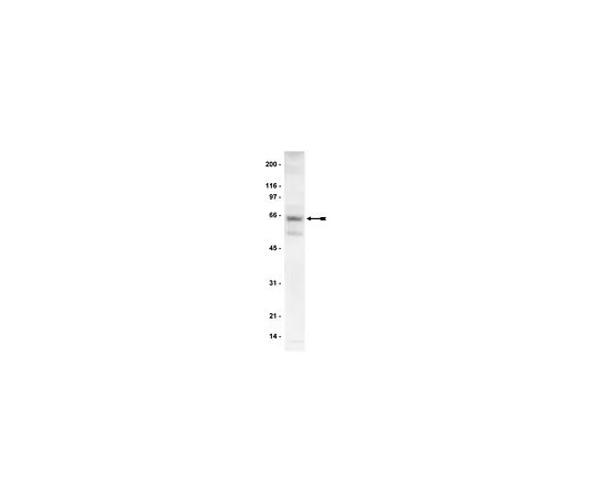 62-8382-36　［Discontinued］Anti-p70 S6 Kinase (S6K); 200 μg　06-926