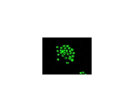 62-8523-14　［Discontinued］Anti-FRA-1, clone EP4711, Rabbit Monoclonal　MABS744