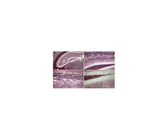 62-8474-76　［Discontinued］BLACK-GOLDR II Stain; 150 mg　AG400