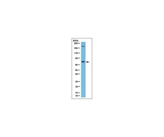 62-8501-61　［Discontinued］Anti-Menin/MEN1, clone 9H1.2　MABC179
