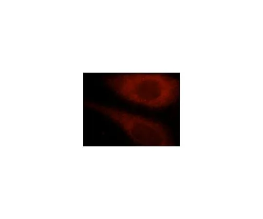 62-8458-07　［Discontinued］Anti-TK1　ABC419